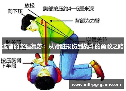 波普的坚强复苏：从肾脏损伤到战斗的勇敢之路